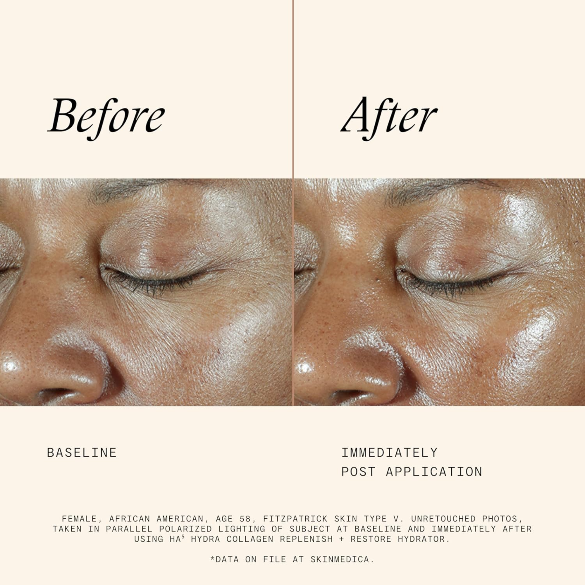 HA⁵® Hydra Collagen Replenish + Restore Hydrator - MariposaSkincare.com