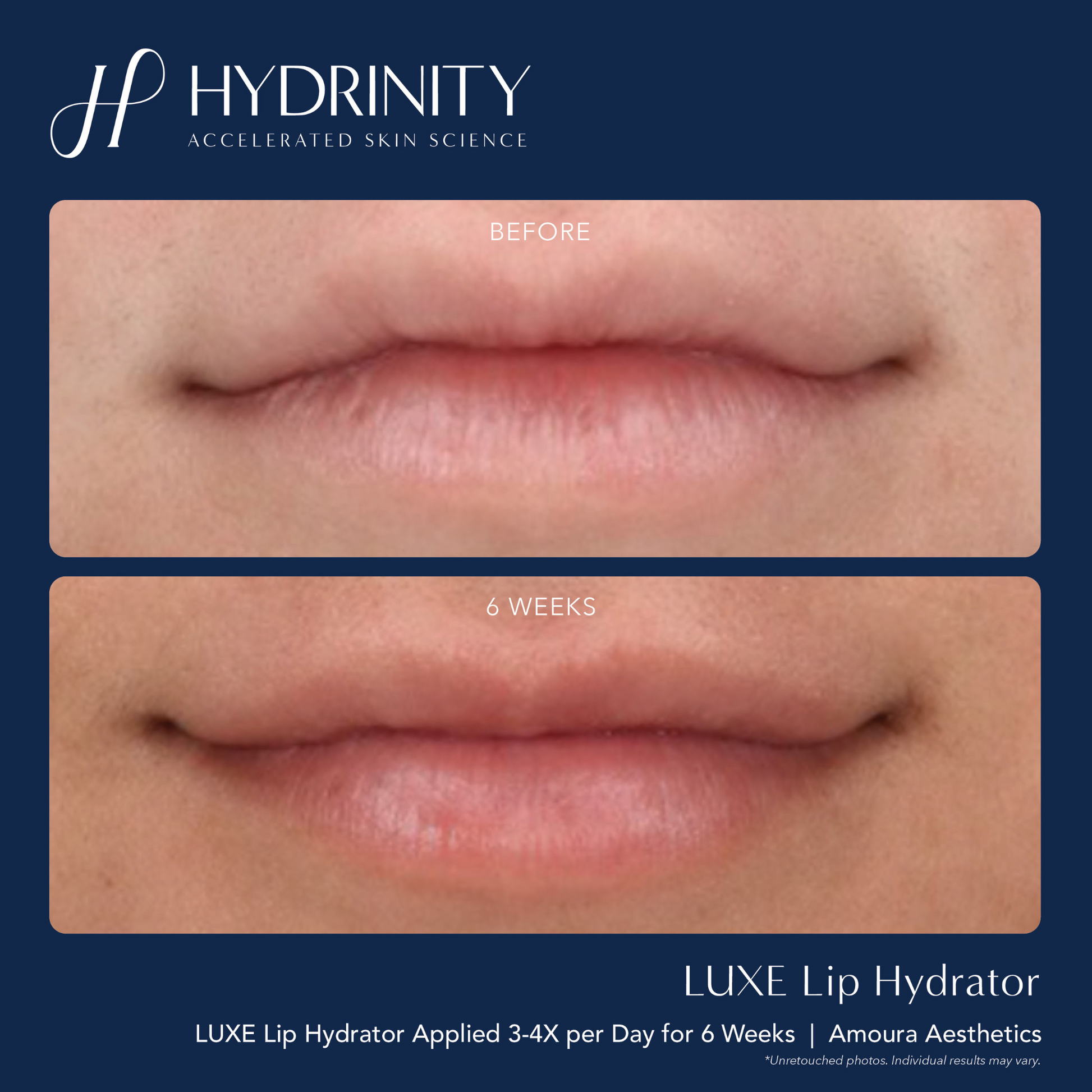 LUXE Lip Hydrator - MariposaSkincare.com