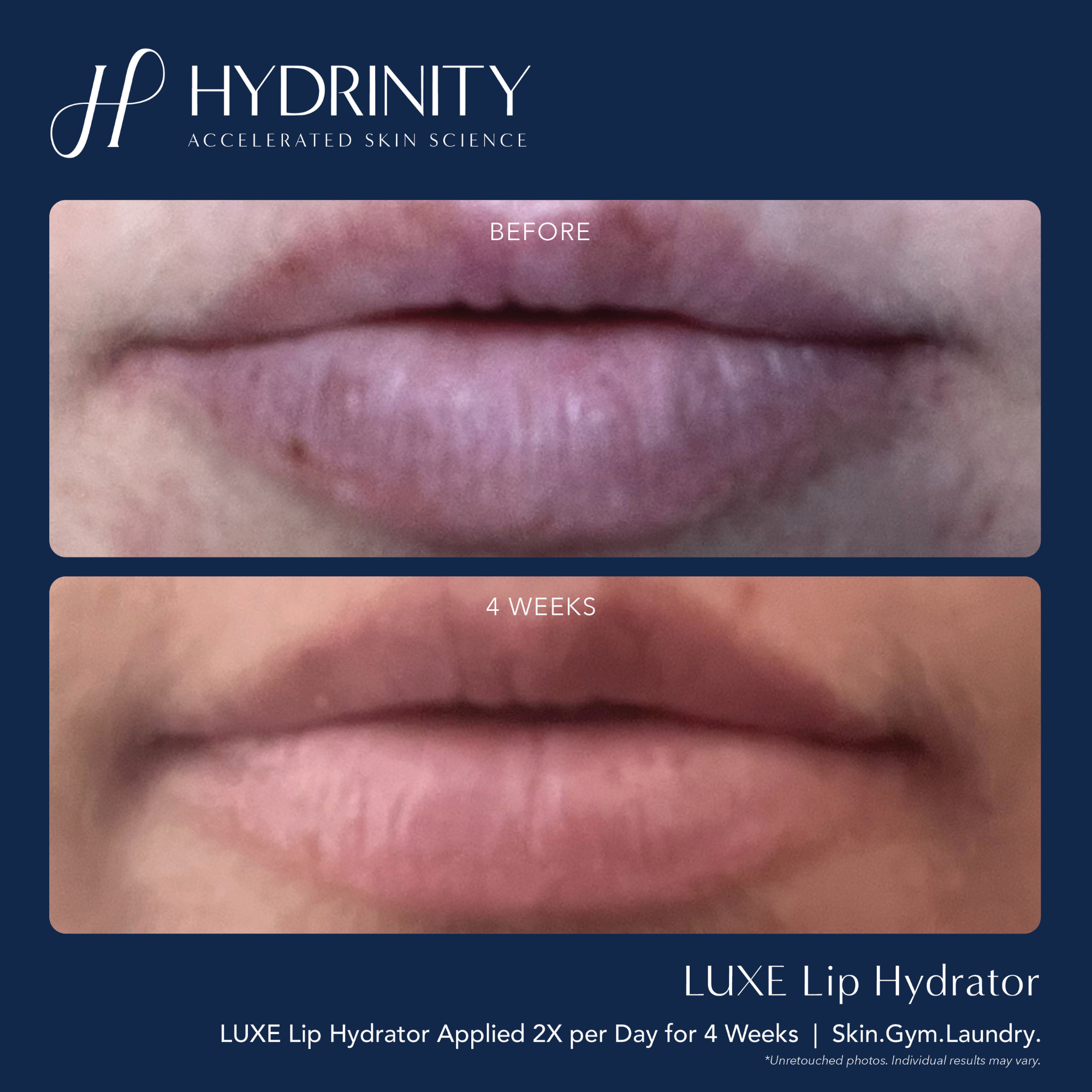 LUXE Lip Hydrator - MariposaSkincare.com