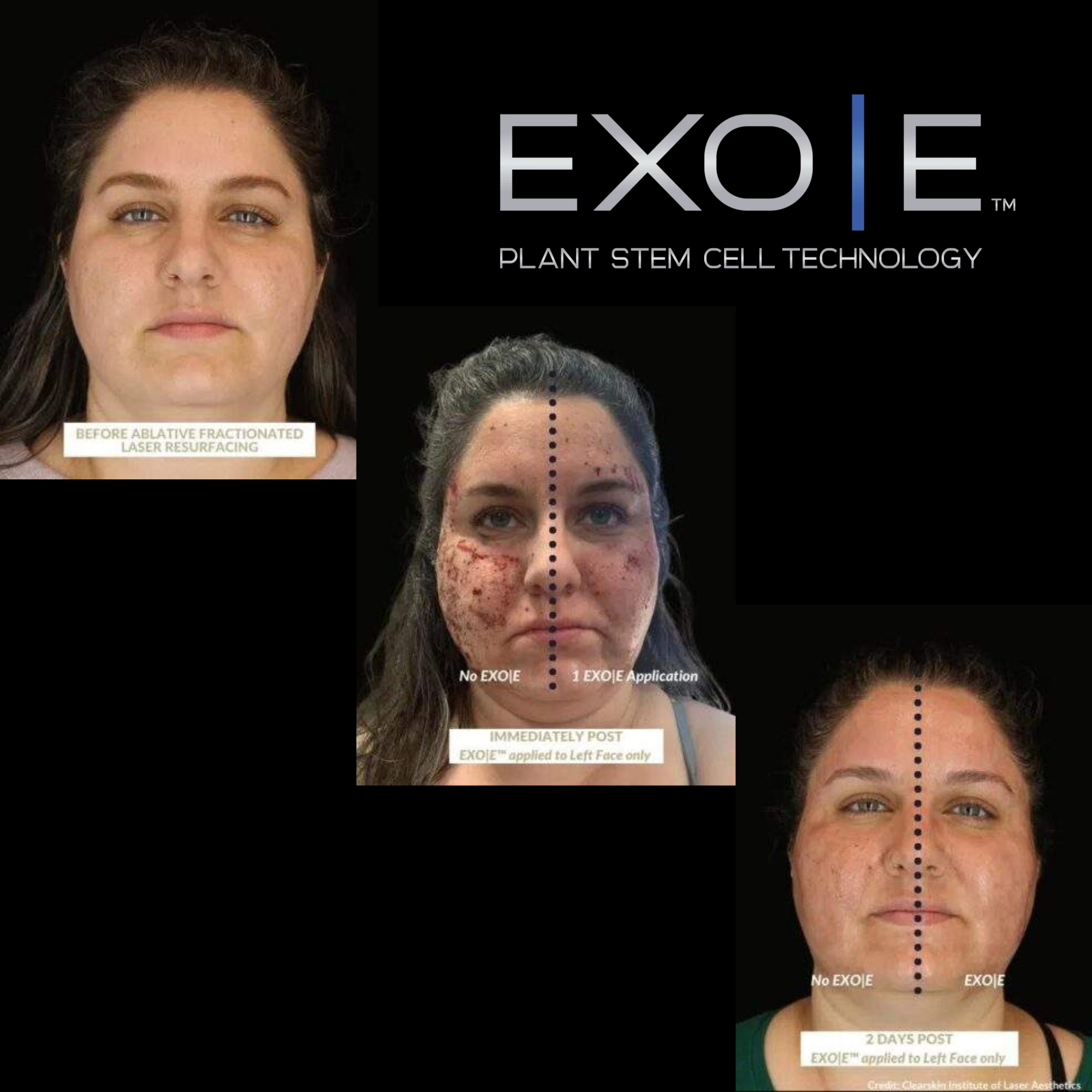 Skin Revitalizing Complex Treatment Kit