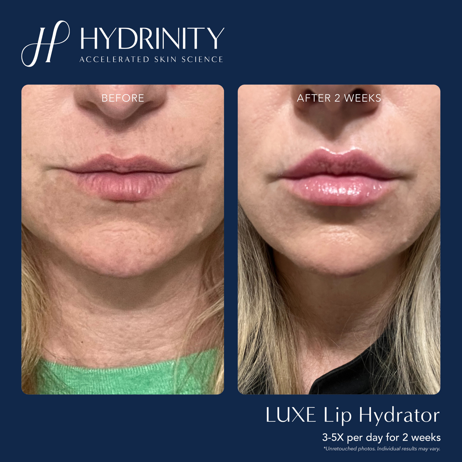 LUXE Lip Hydrator - MariposaSkincare.com