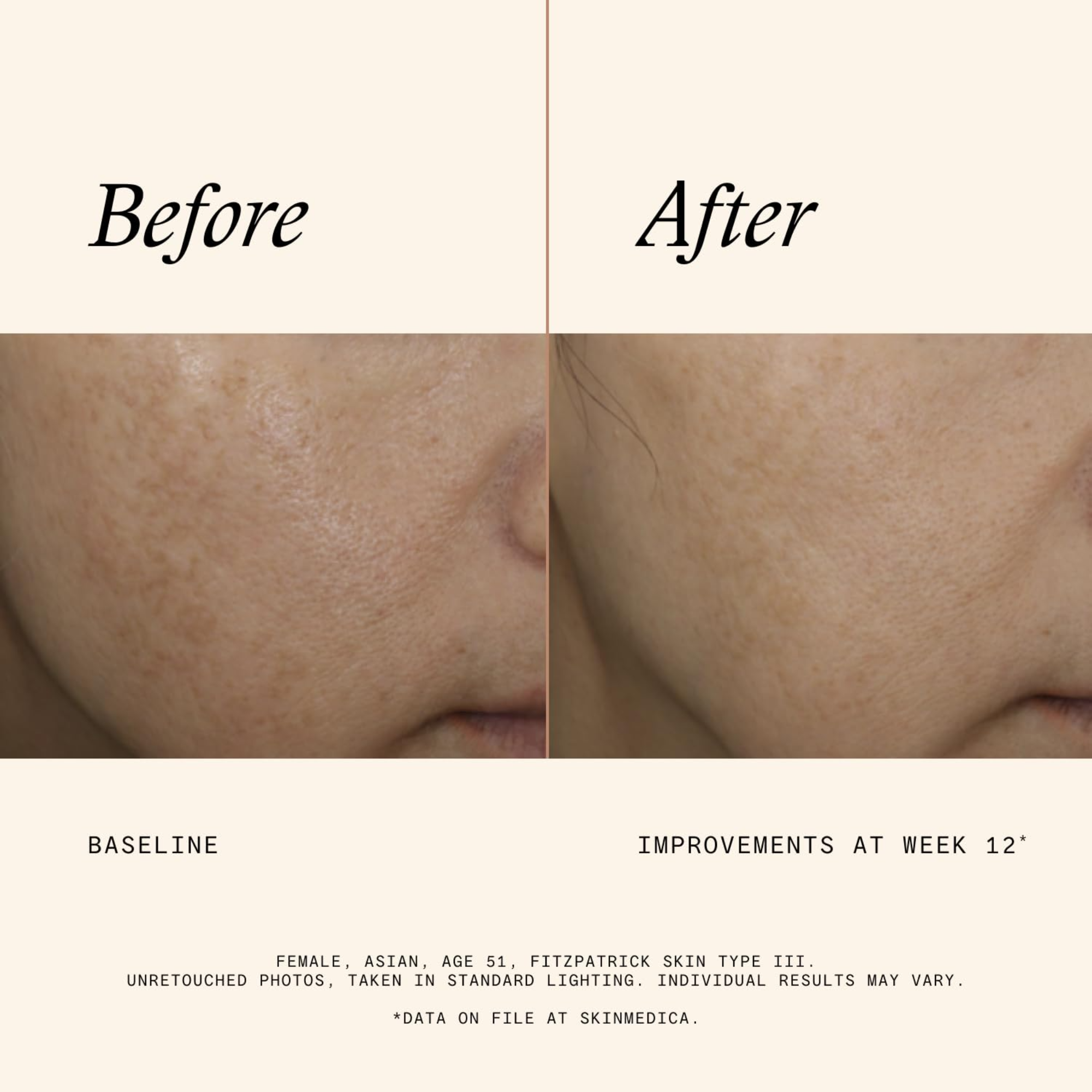 Even & Correct Advanced Brightening Treatment