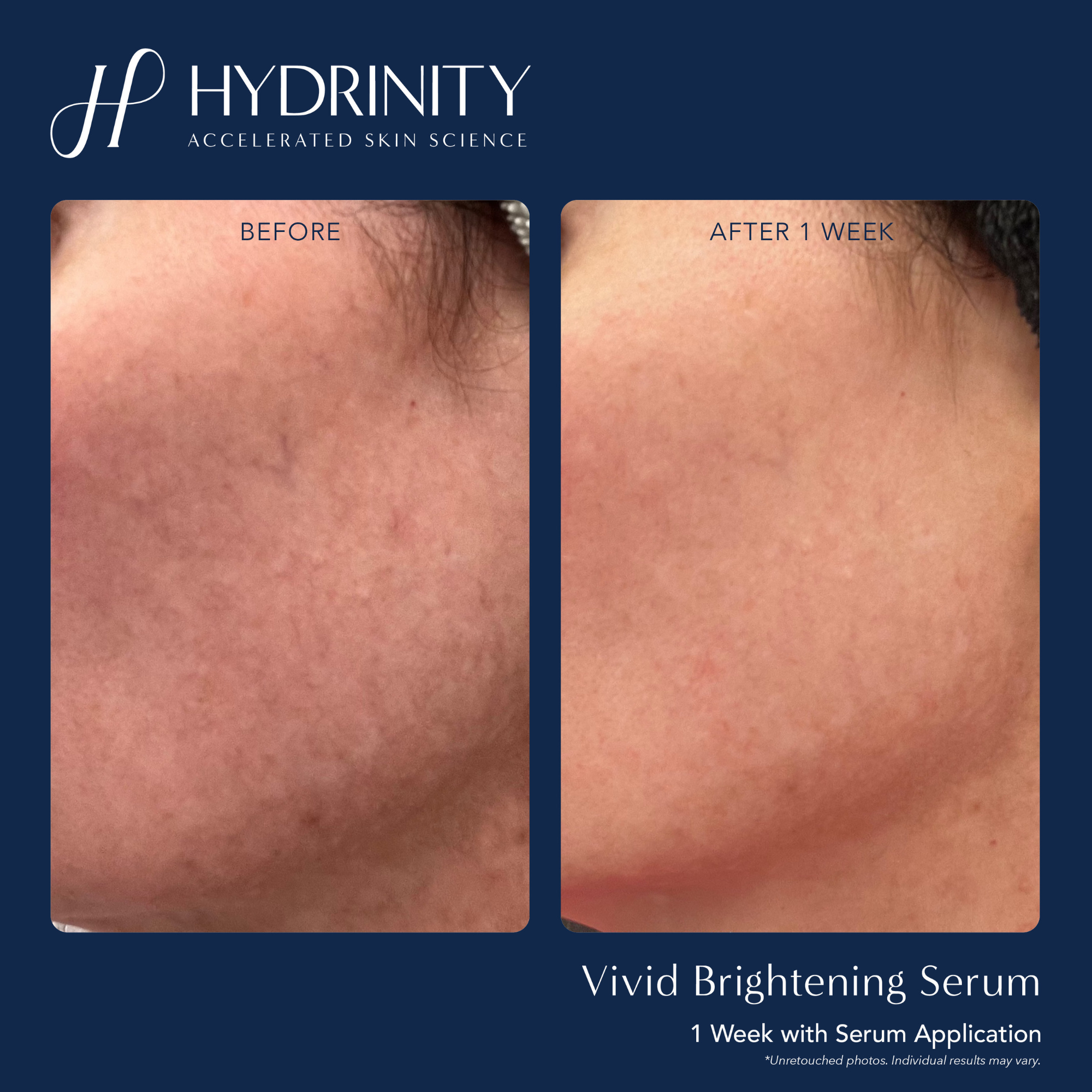 VIVID Brightening Serum - MariposaSkincare.com