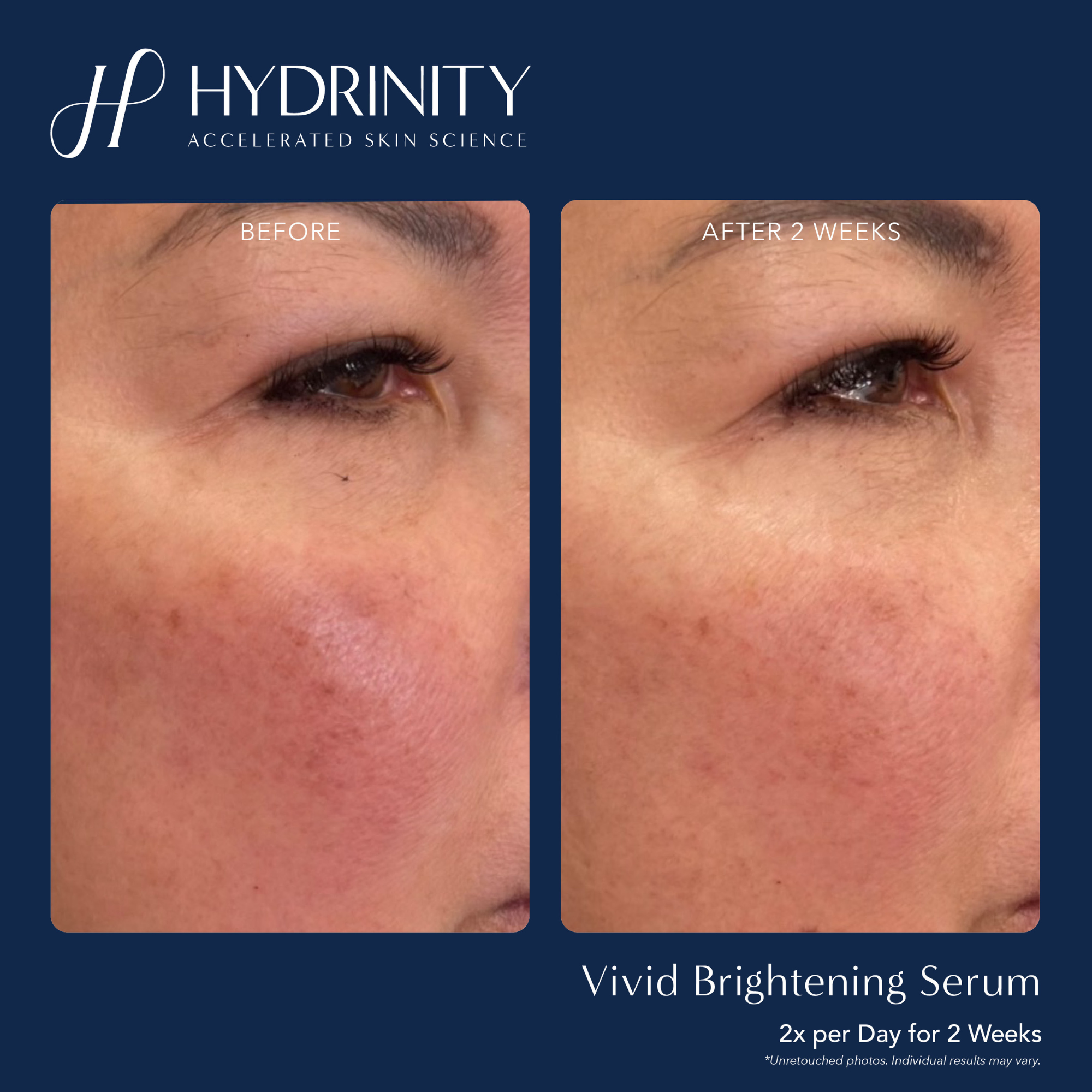 VIVID Brightening Serum - MariposaSkincare.com