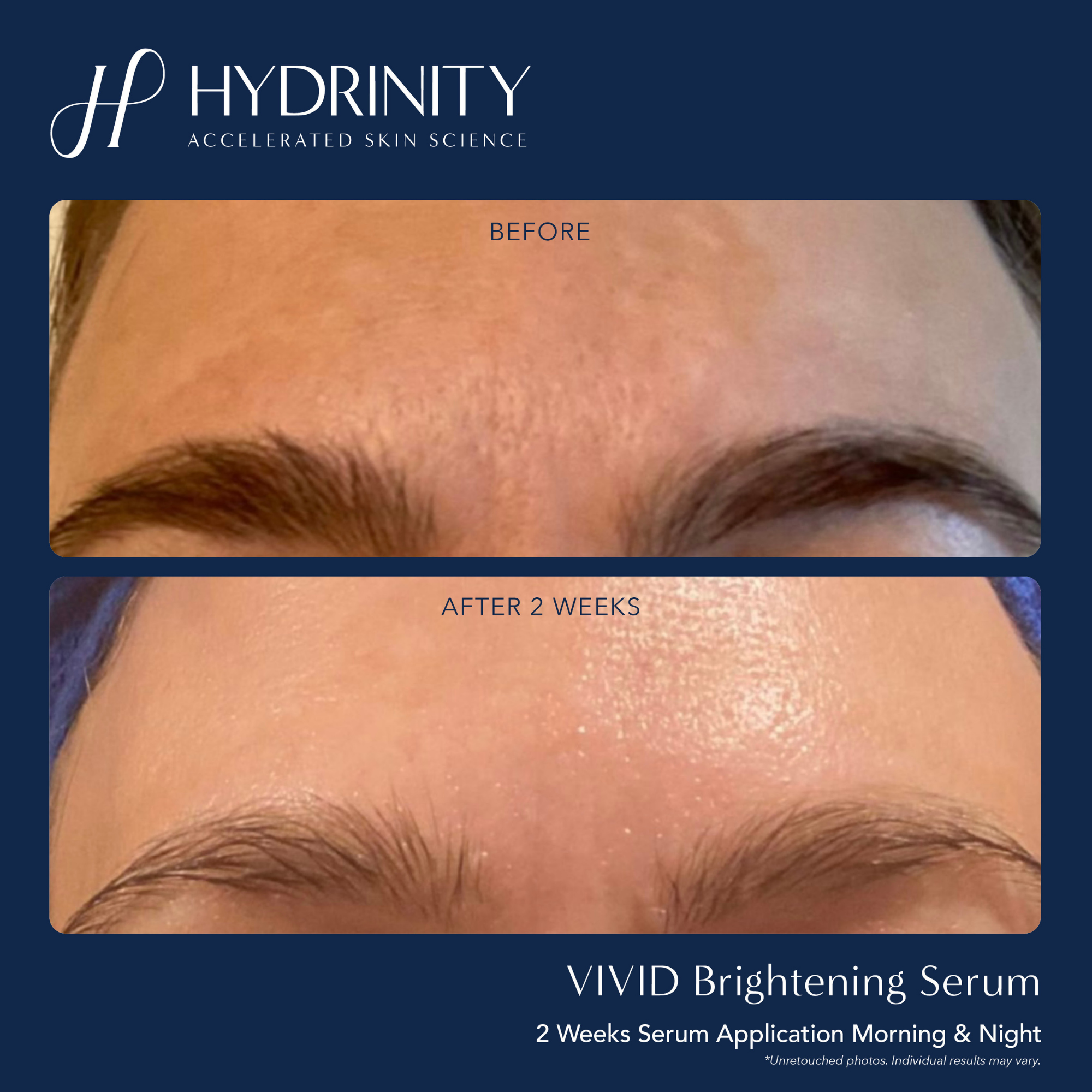 VIVID Brightening Serum - MariposaSkincare.com