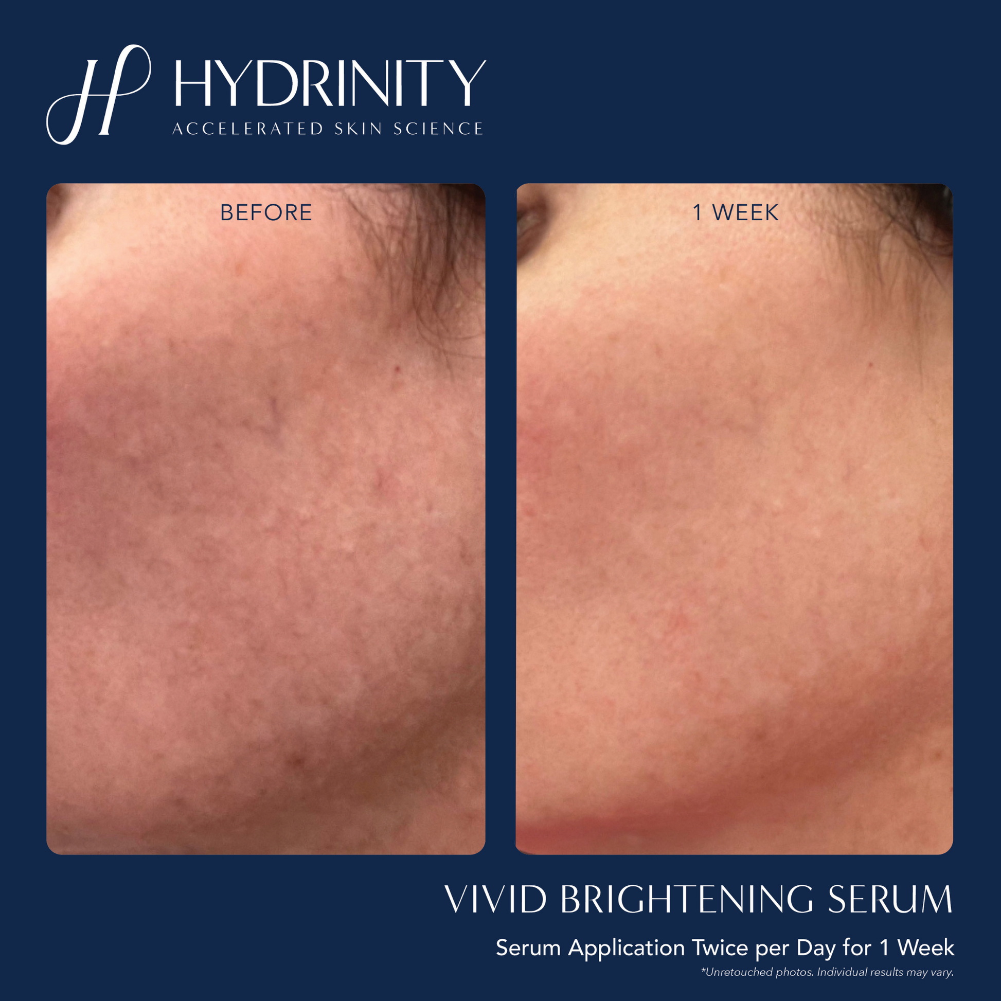 VIVID Brightening Serum - MariposaSkincare.com