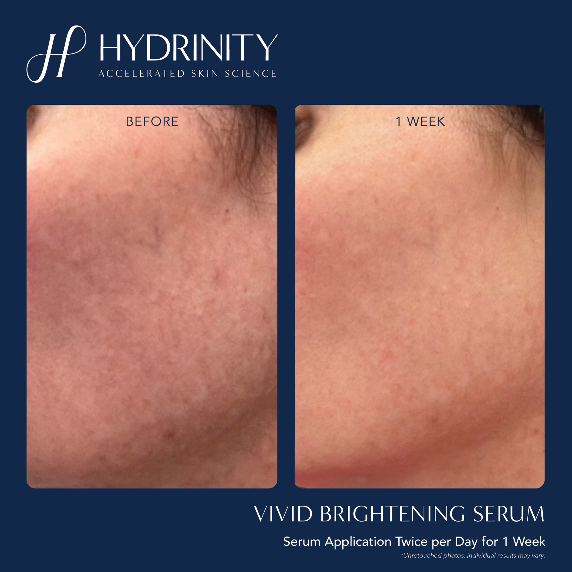 VIVID Brightening Serum - MariposaSkincare.com