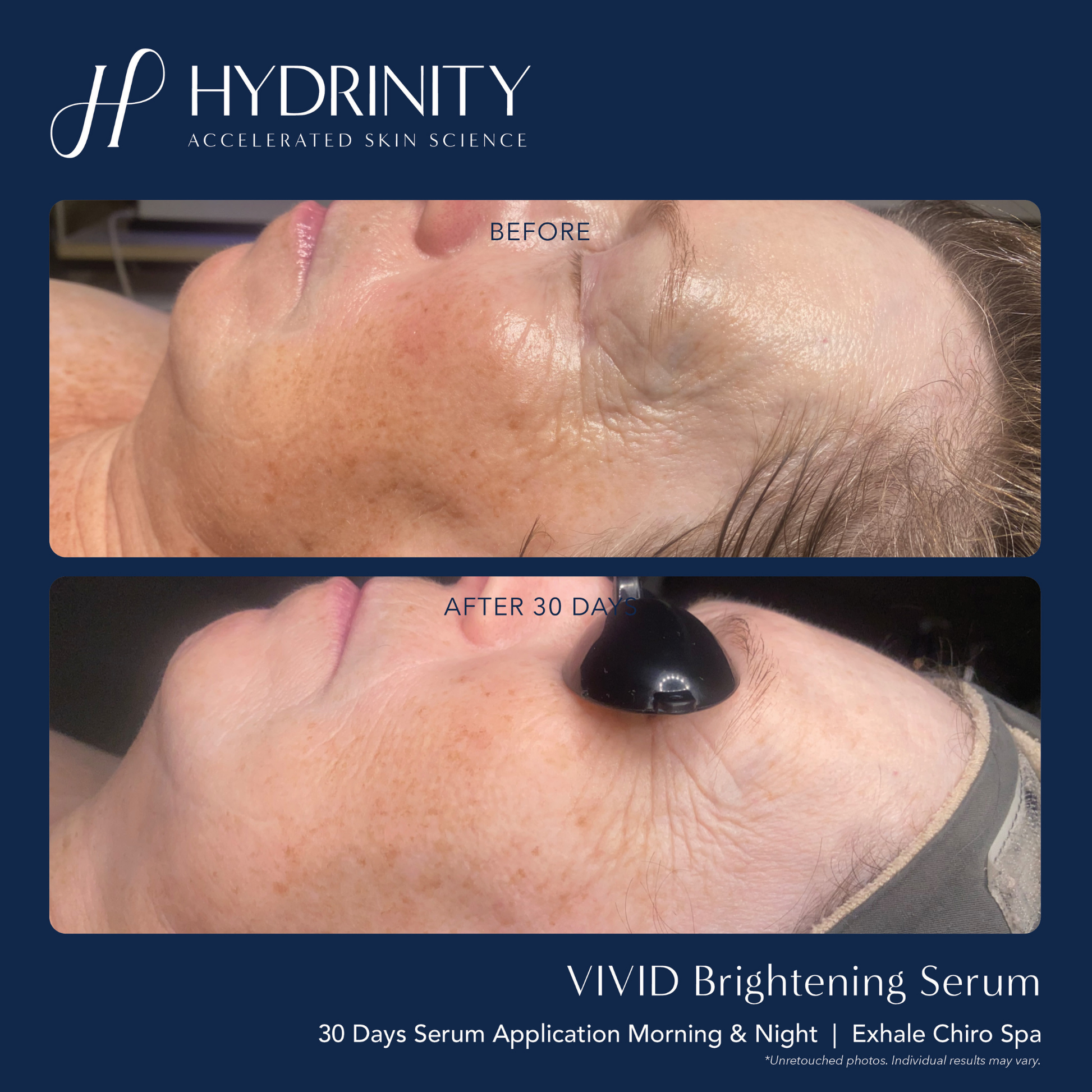 VIVID Brightening Serum - MariposaSkincare.com