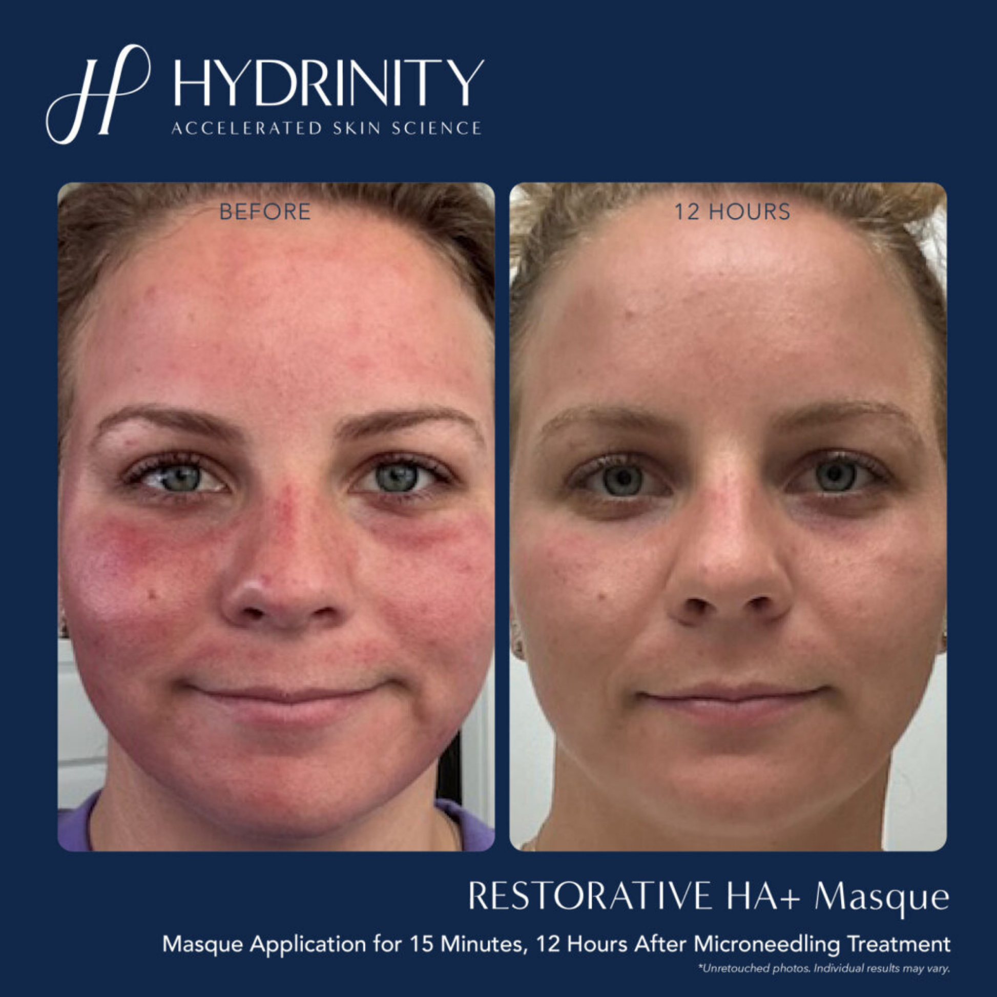 Restorative HA+ Masque - MariposaSkincare.com
