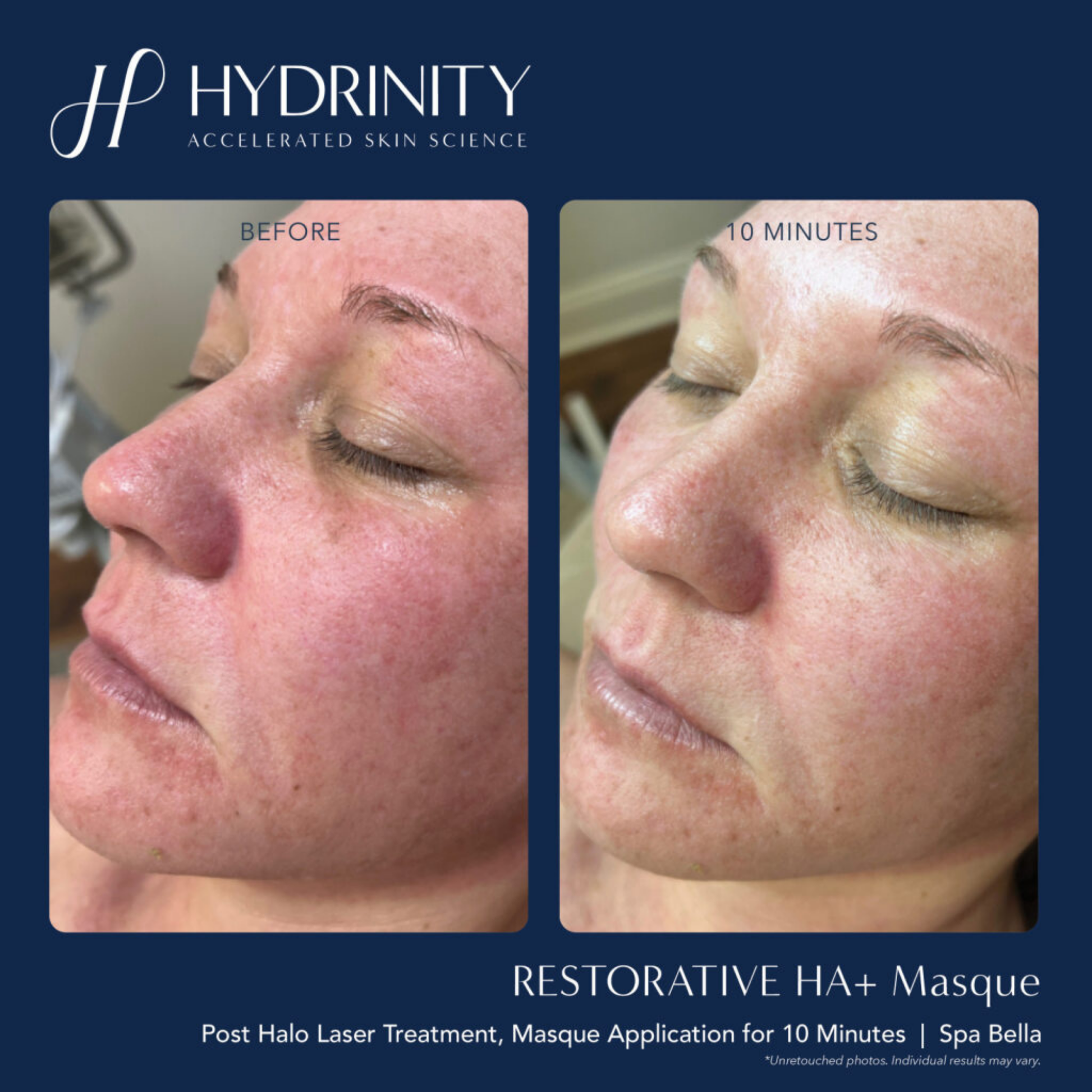 Restorative HA+ Masque - MariposaSkincare.com