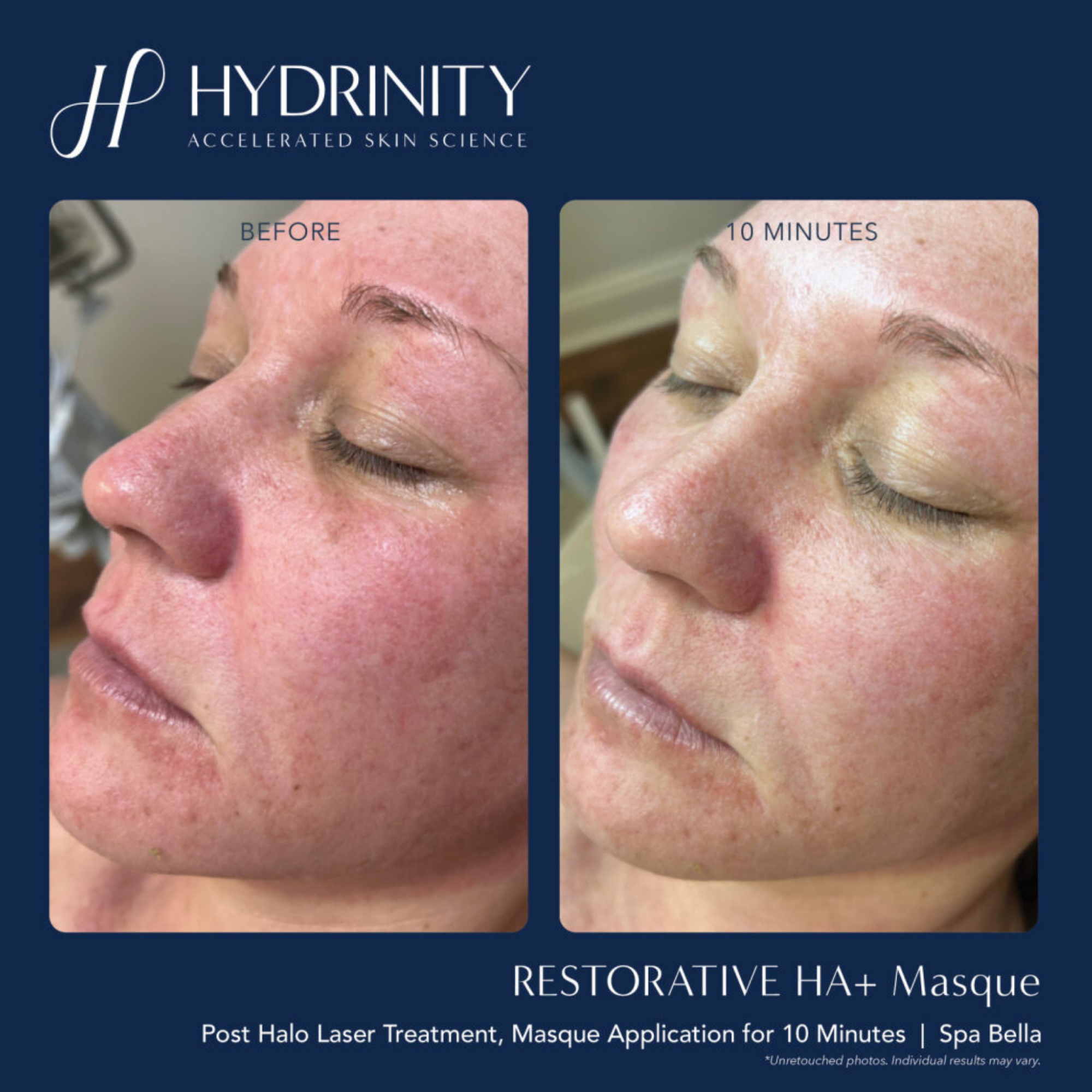 Restorative HA+ Masque - MariposaSkincare.com