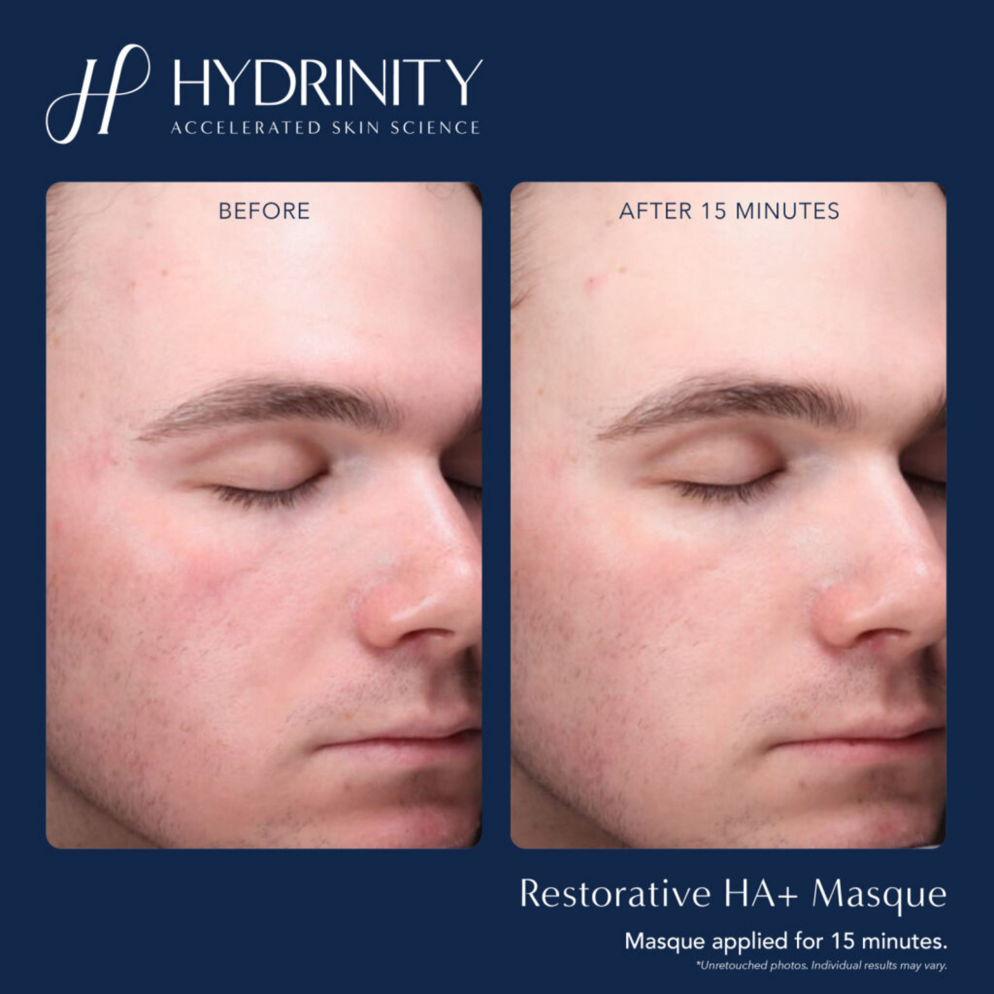Restorative HA+ Masque - MariposaSkincare.com