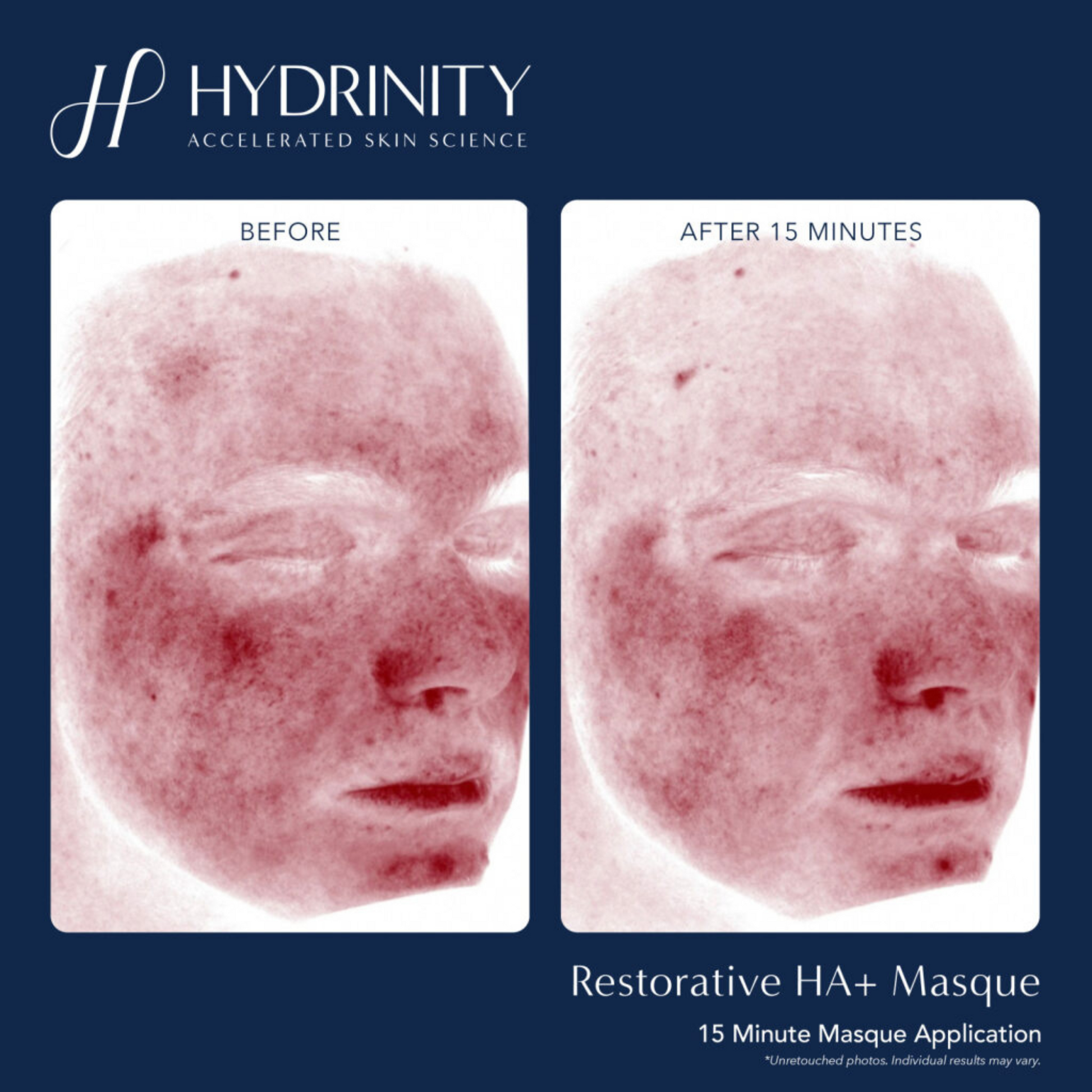 Restorative HA+ Masque - MariposaSkincare.com