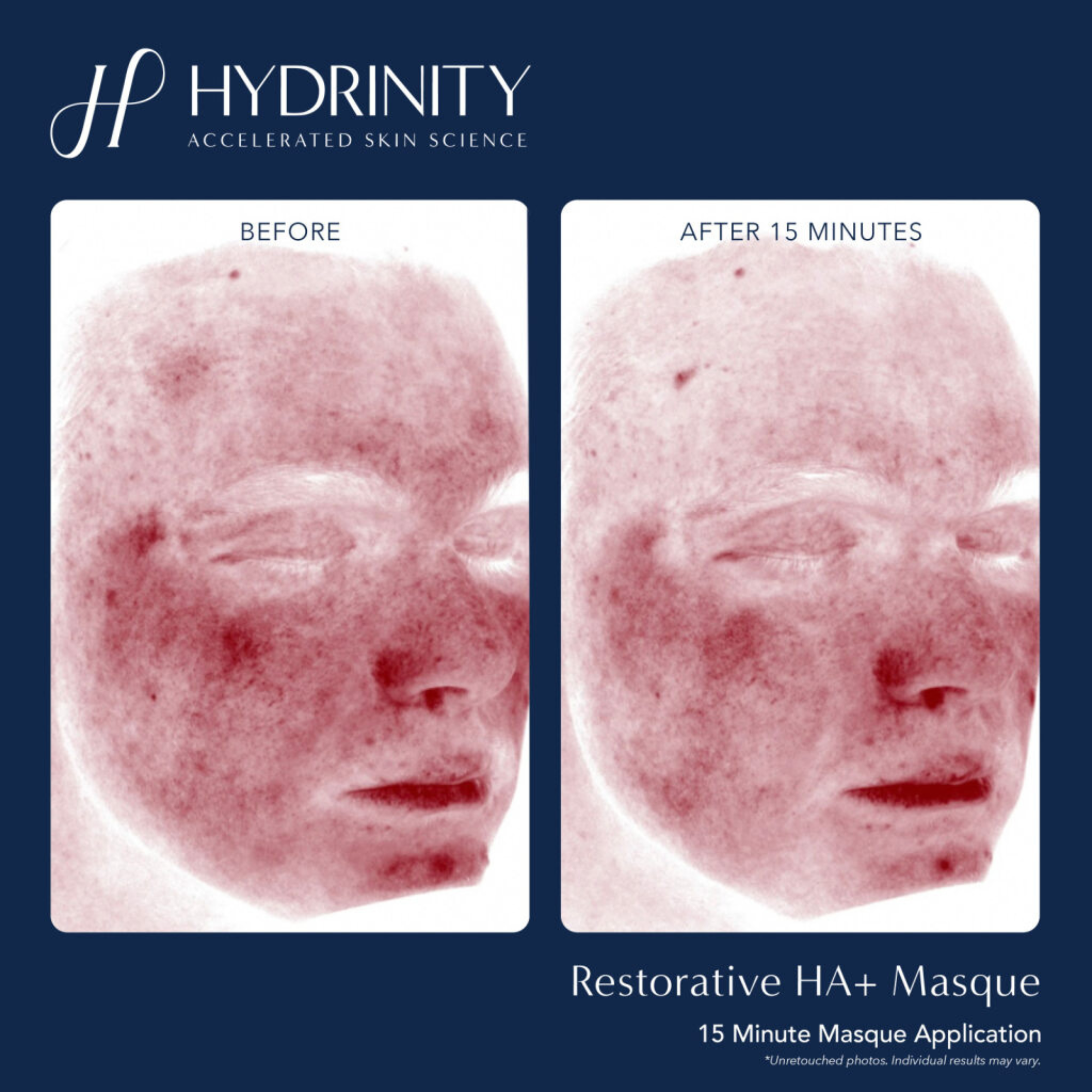 Restorative HA+ Masque - MariposaSkincare.com