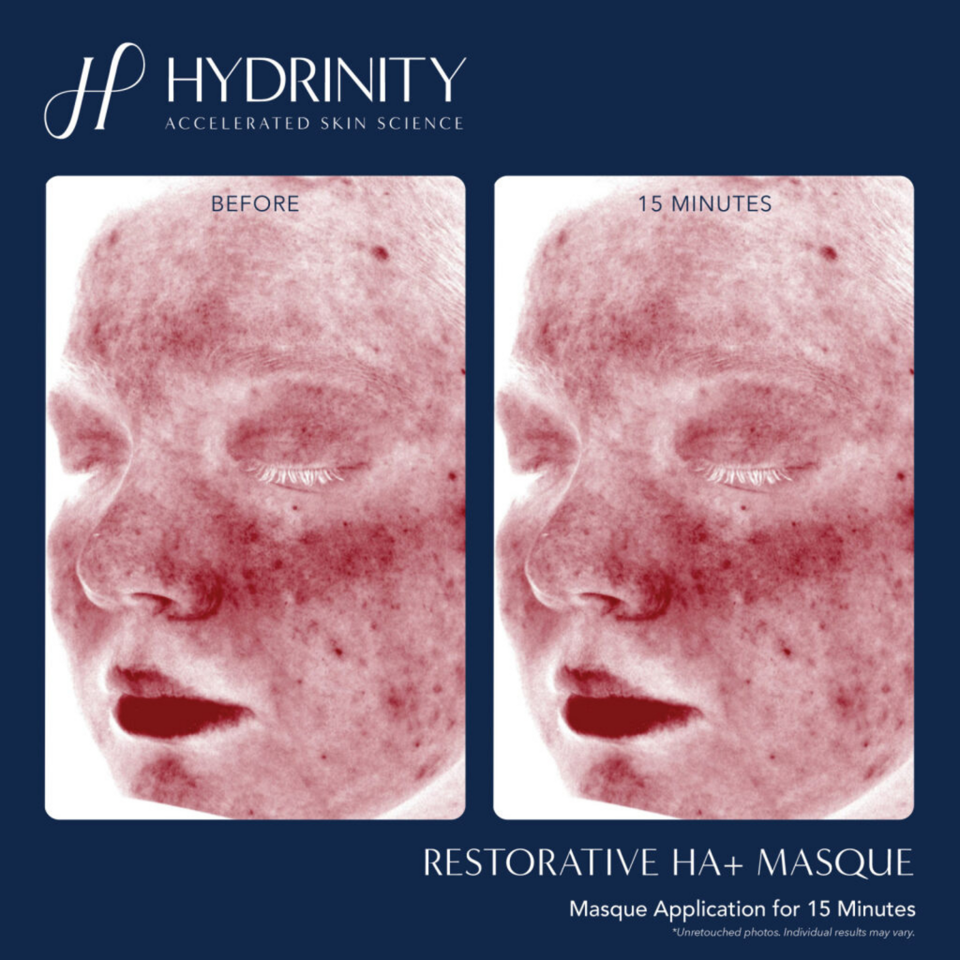 Restorative HA+ Masque - MariposaSkincare.com