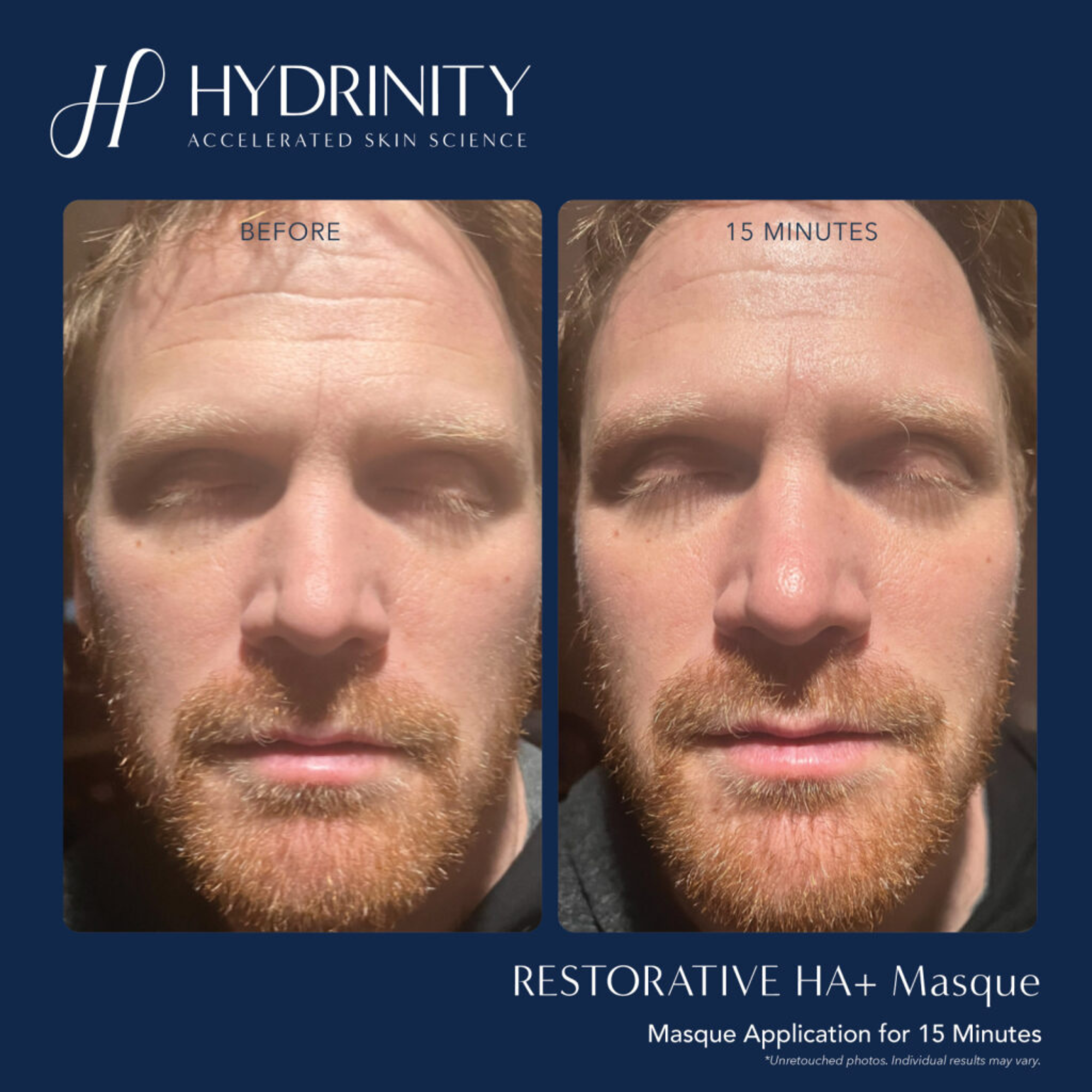 Restorative HA+ Masque - MariposaSkincare.com