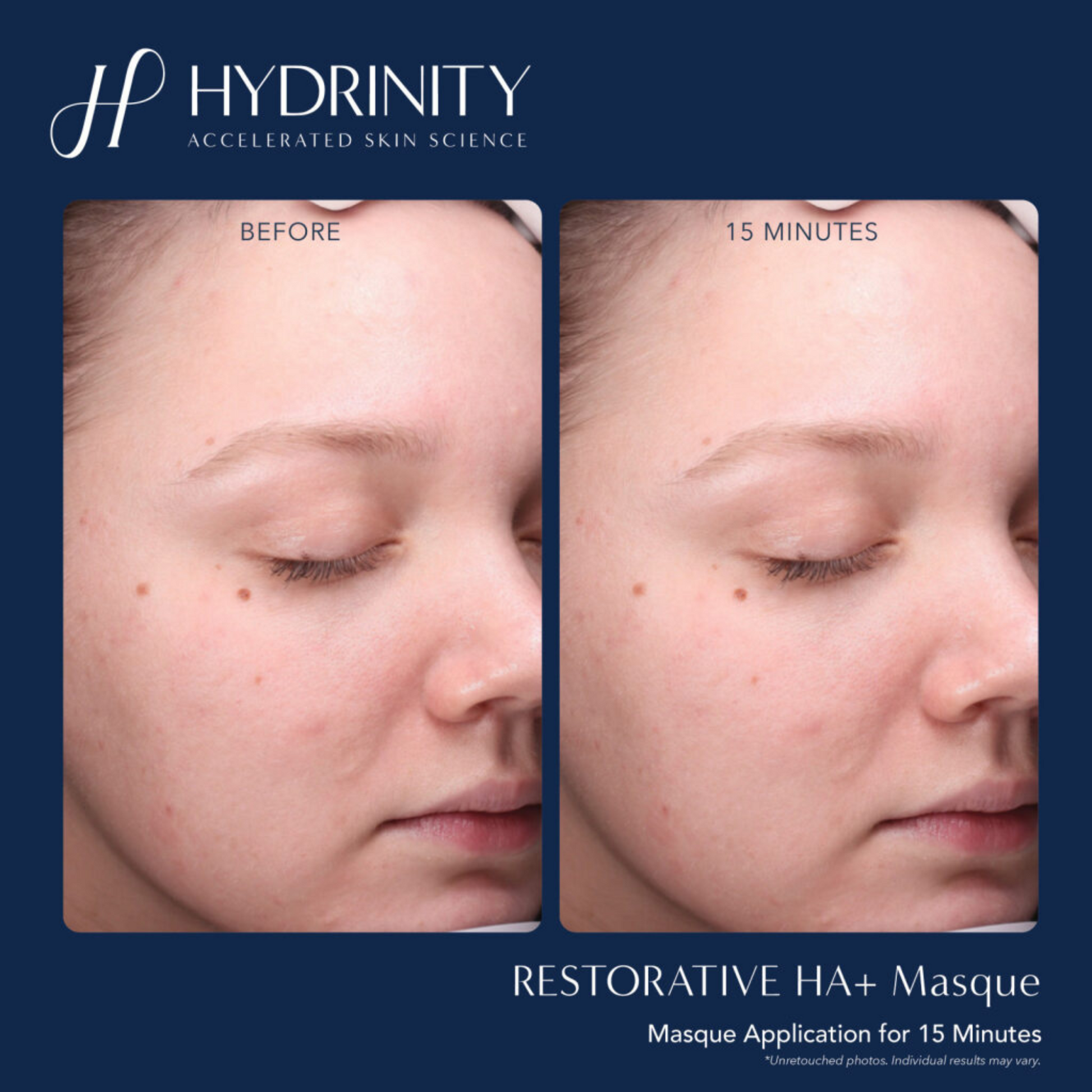 Restorative HA+ Masque - MariposaSkincare.com