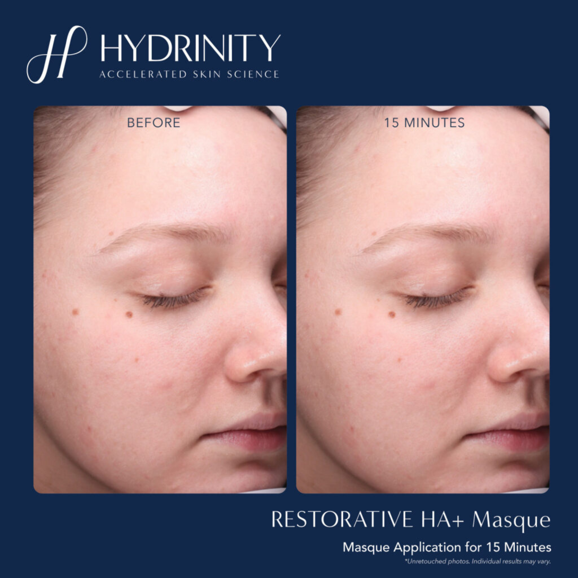 Restorative HA+ Masque - MariposaSkincare.com