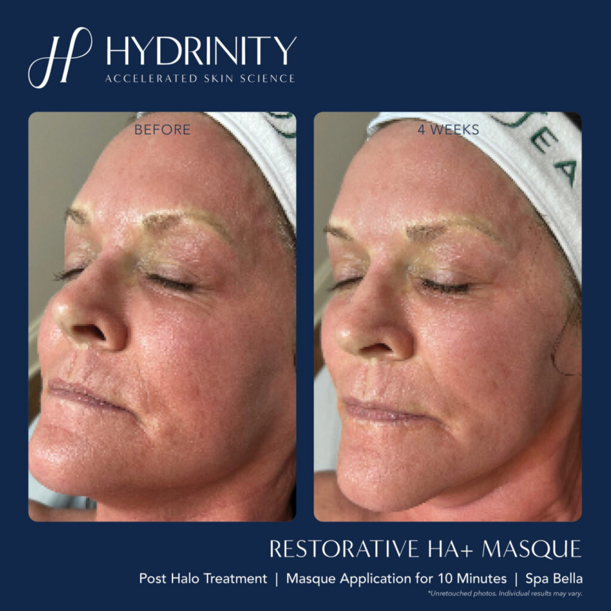 Restorative HA+ Masque - MariposaSkincare.com
