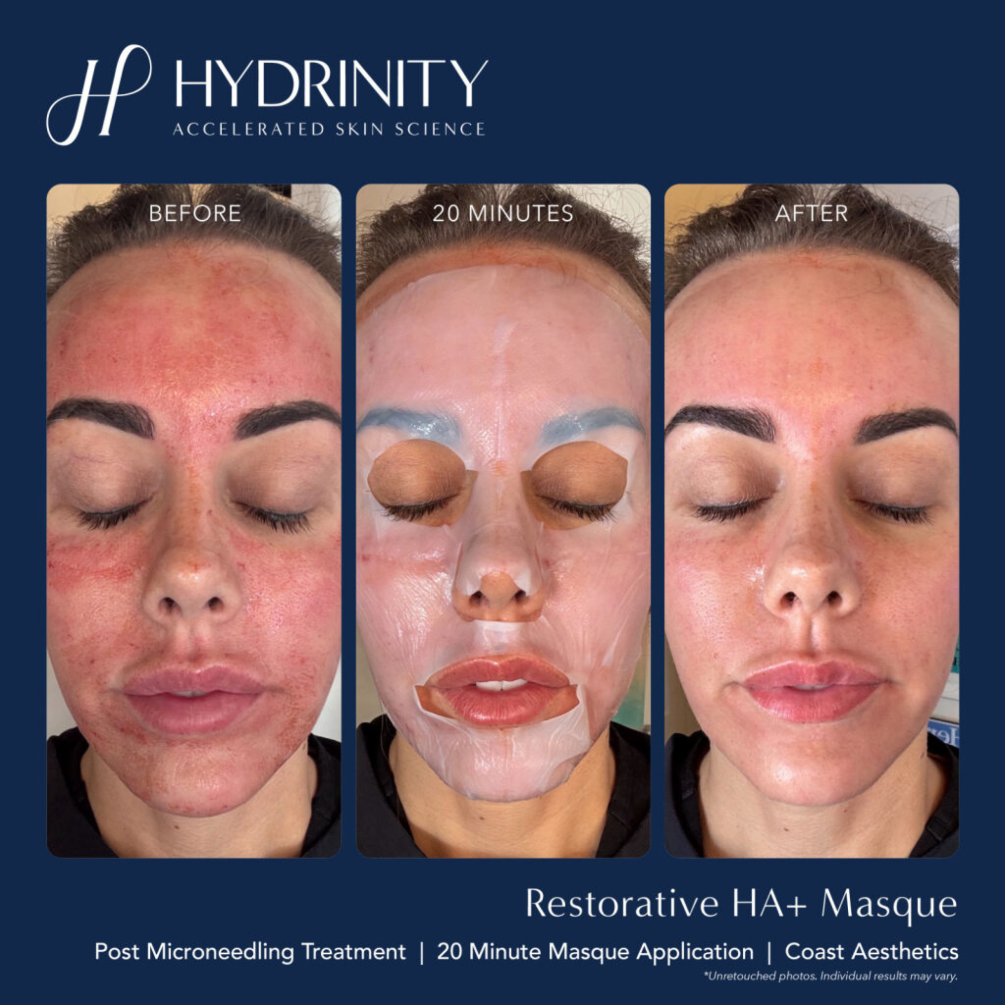 Restorative HA+ Masque - MariposaSkincare.com