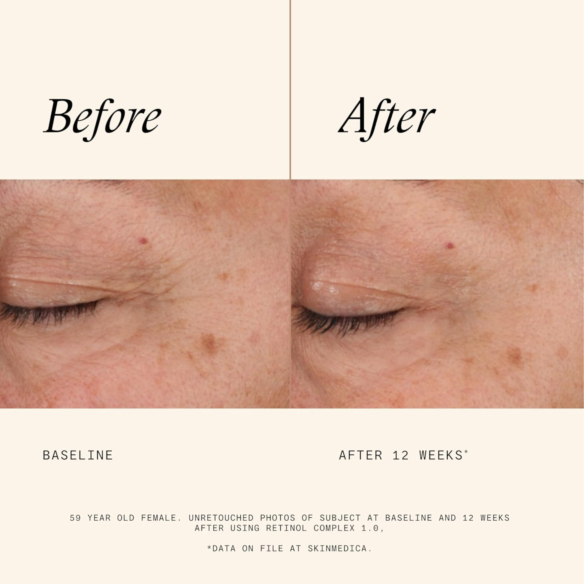 Retinol Complex 1.0 - MariposaSkincare.com