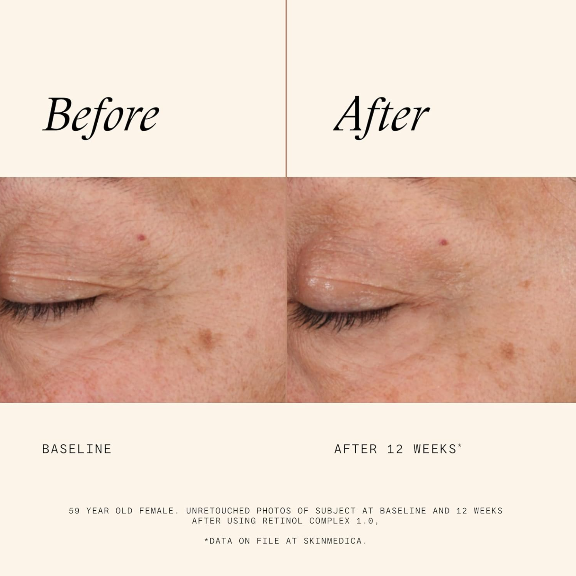 Retinol Complex 1.0 - MariposaSkincare.com