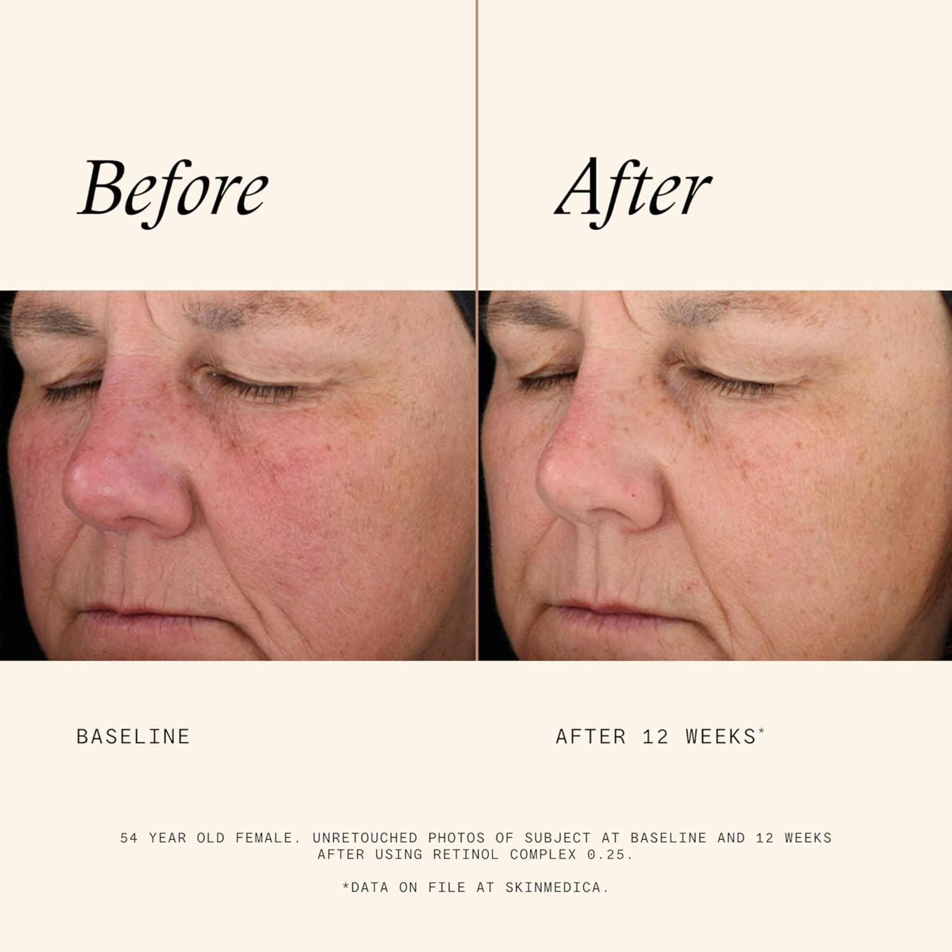 Retinol Complex 0.25 - MariposaSkincare.com