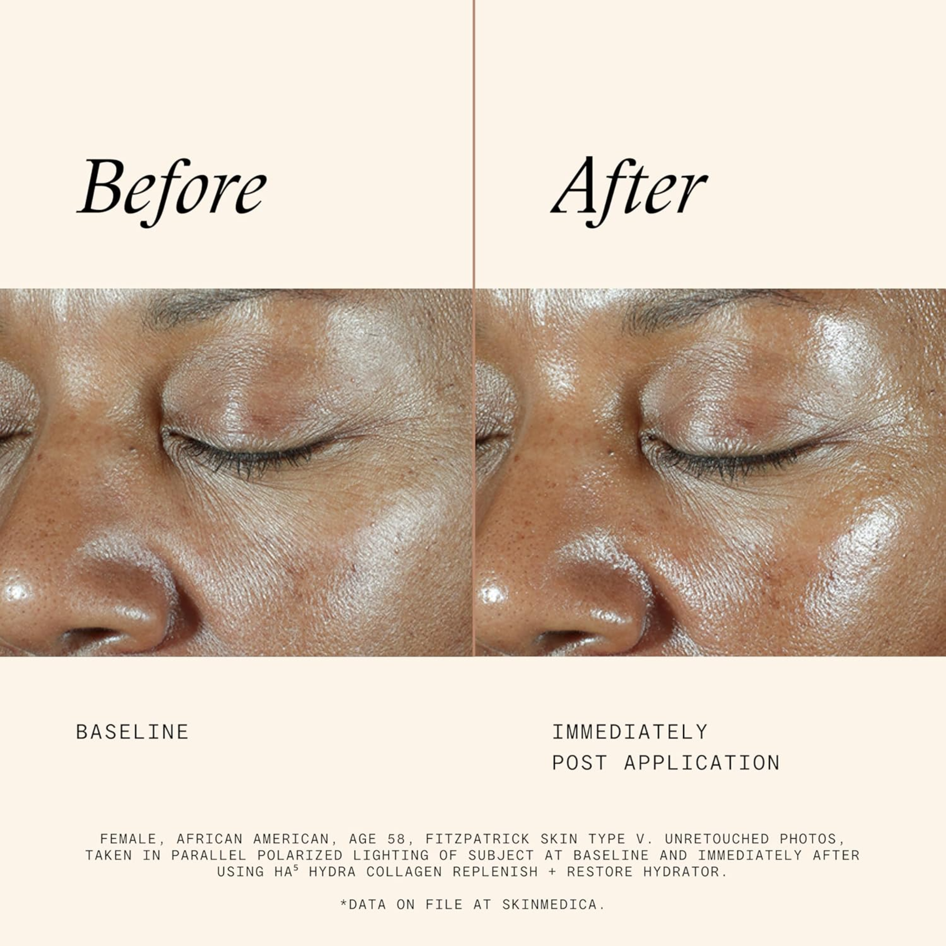 HA⁵® Hydra Collagen Replenish + Restore Hydrator - MariposaSkincare.com