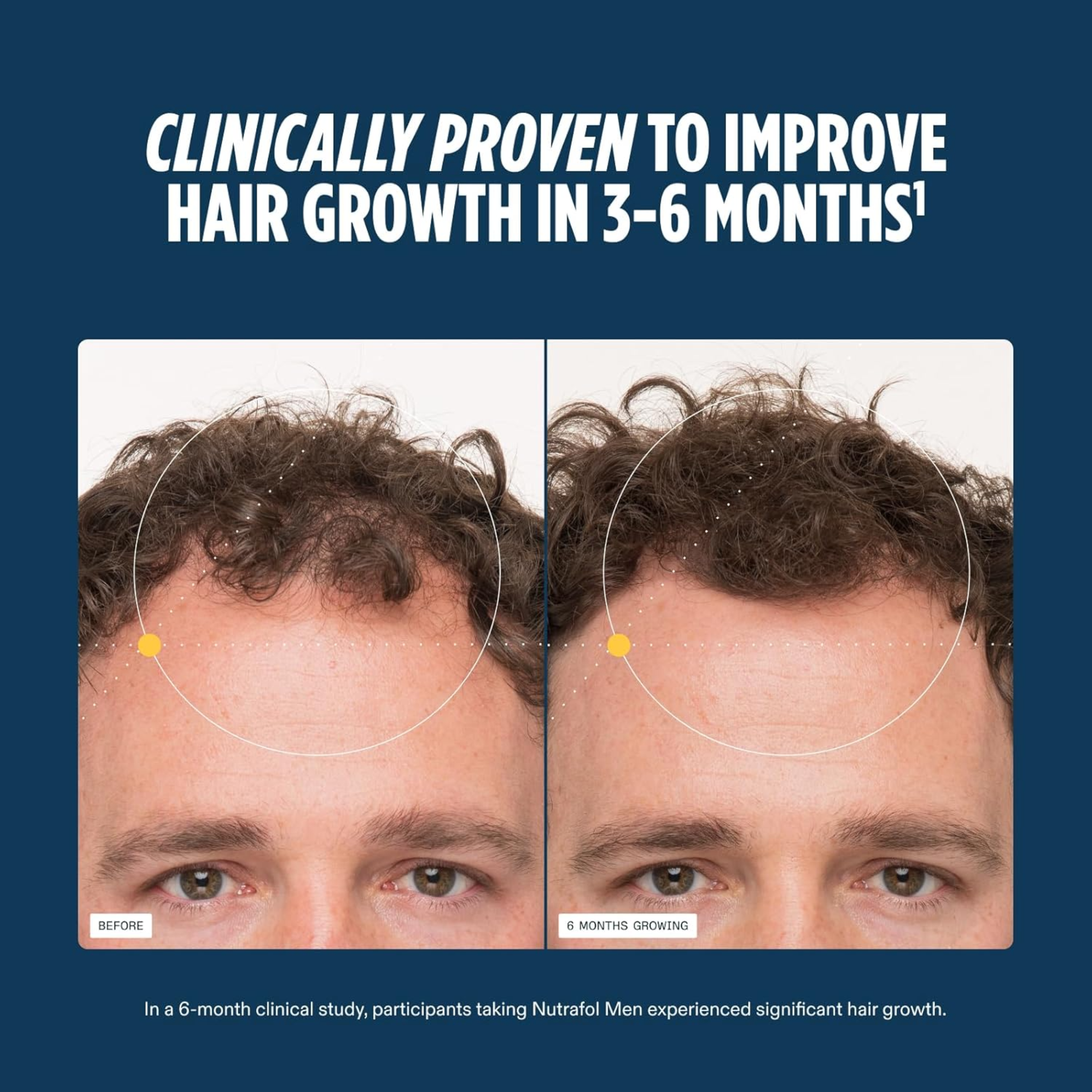 MEN Hair Growth Supplements, Clinically Tested, Dermatologist Recommended - MariposaSkincare.com