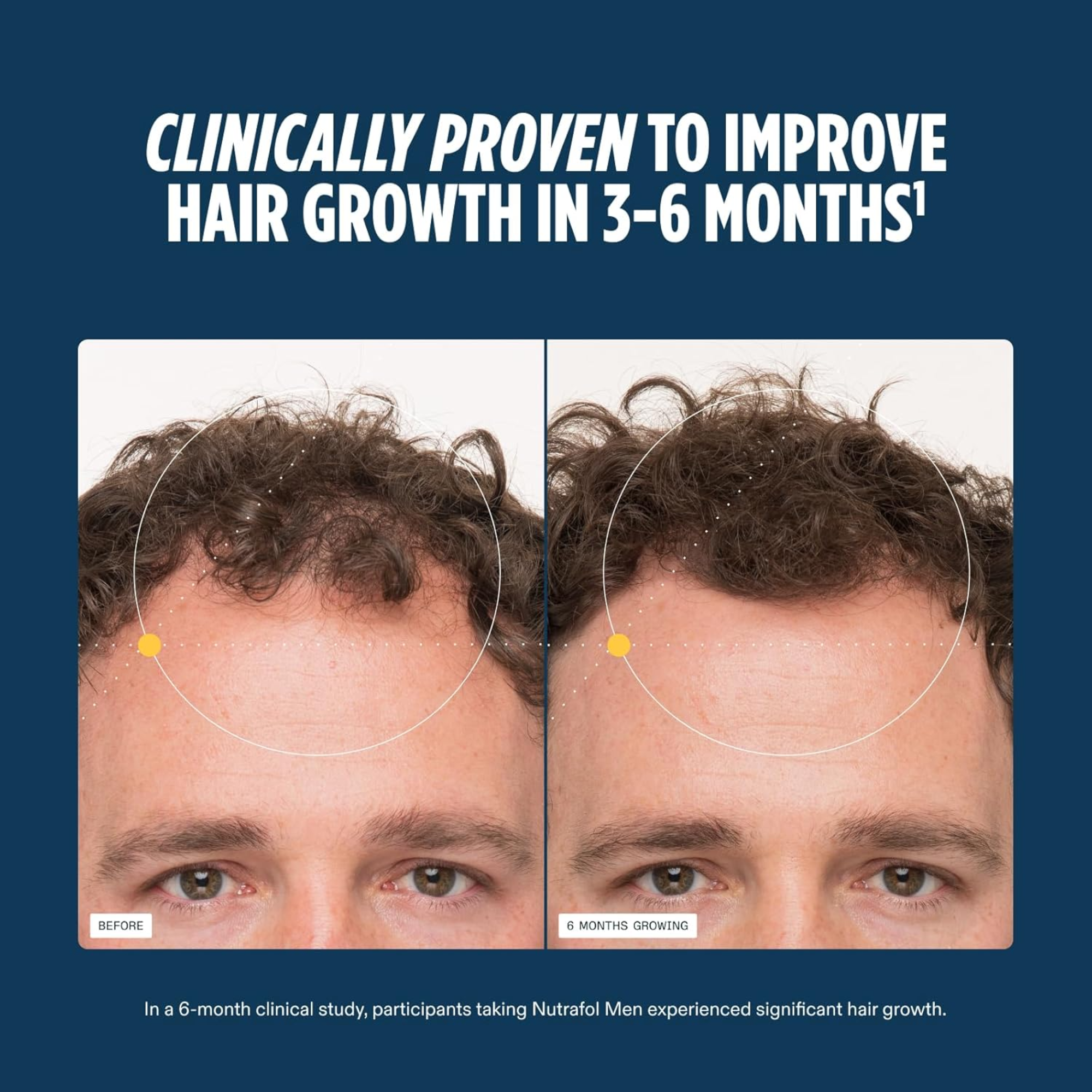 MEN Hair Growth Supplements, Clinically Tested, Dermatologist Recommended - MariposaSkincare.com