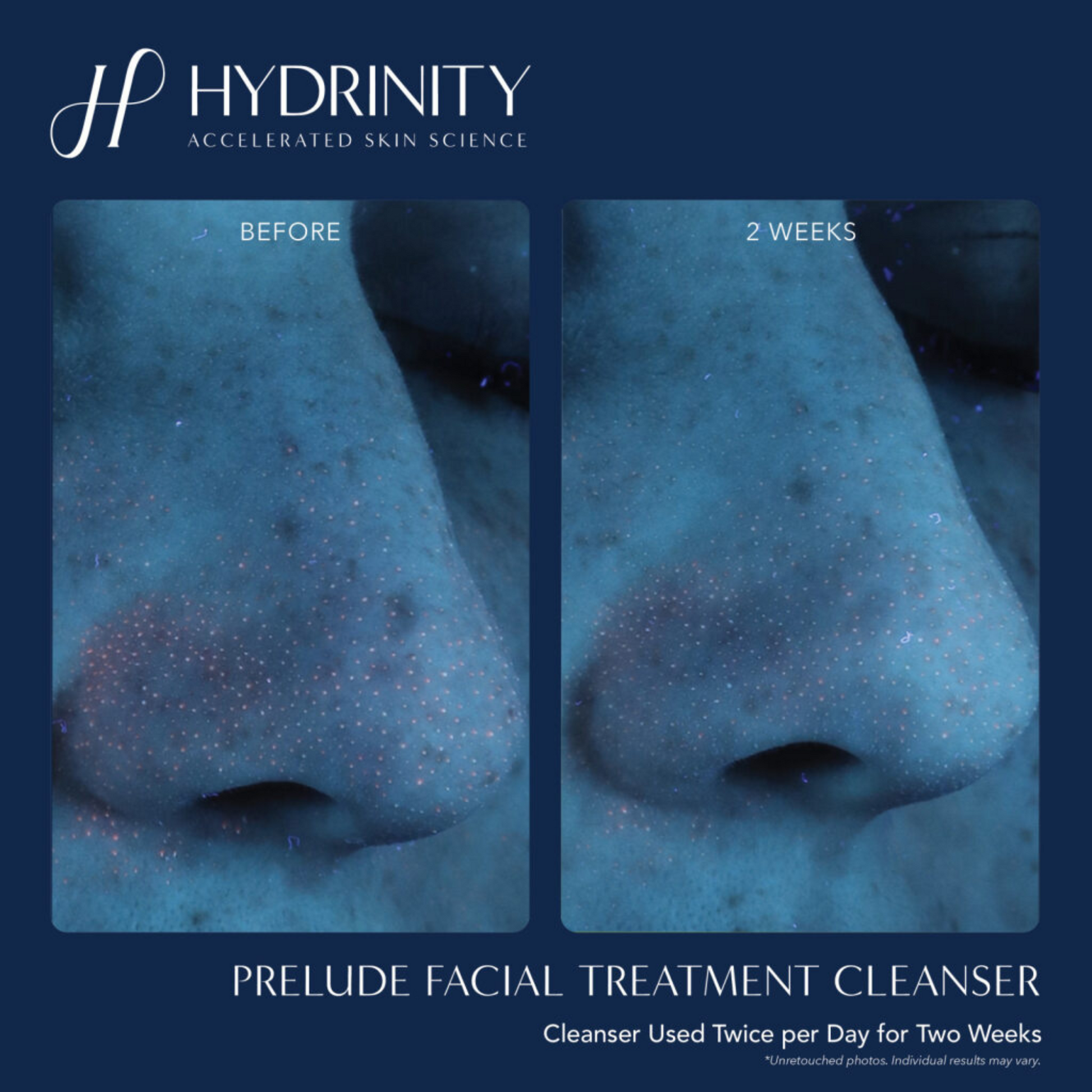 PRELUDE Facial Treatment Cleanser - MariposaSkincare.com