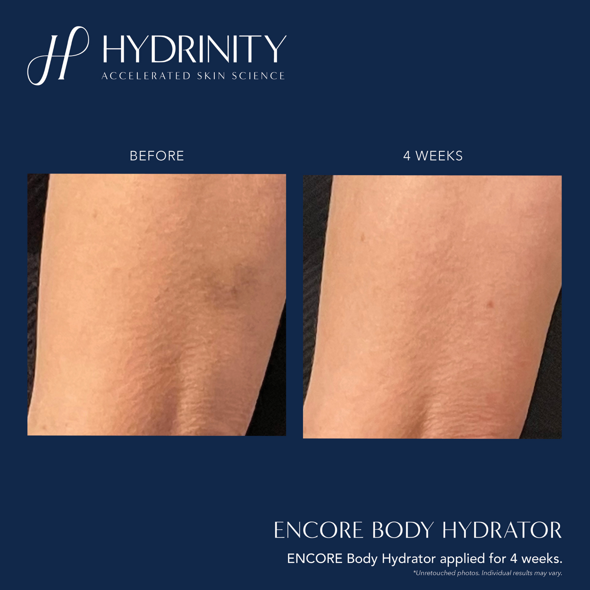 ENCORE Body Hydrator - MariposaSkincare.com