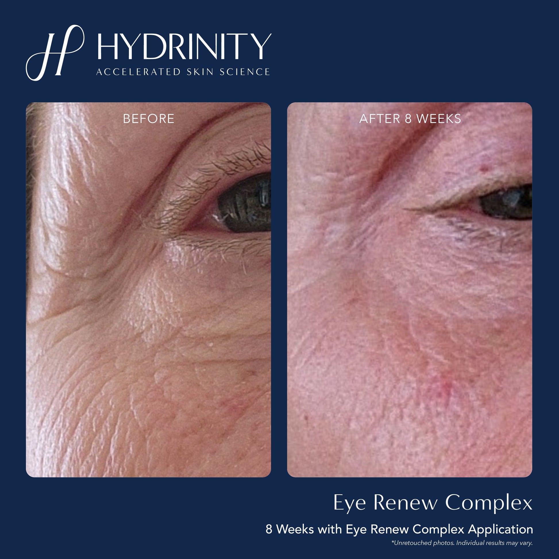 Eye Renew Complex - MariposaSkincare.com