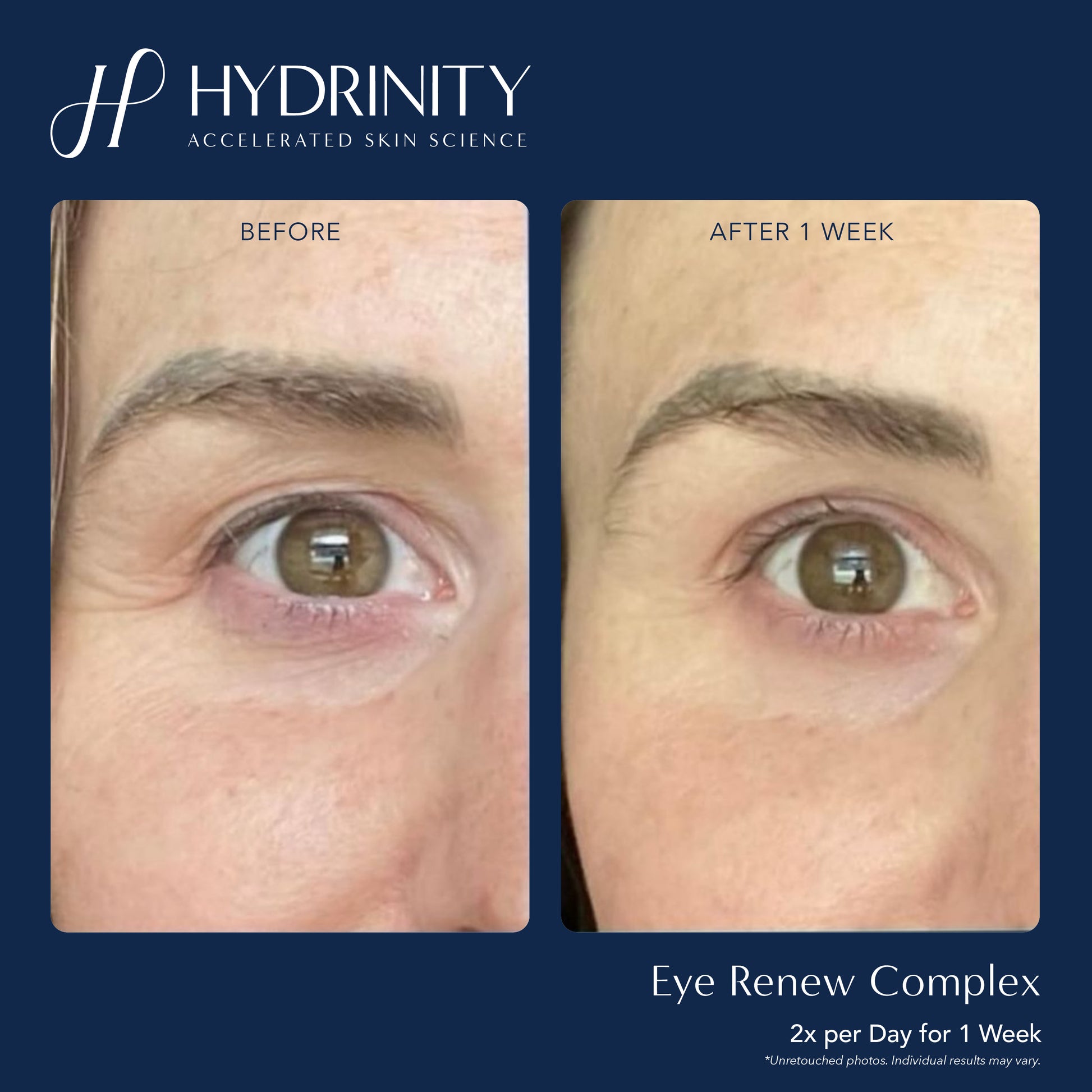 Eye Renew Complex - MariposaSkincare.com