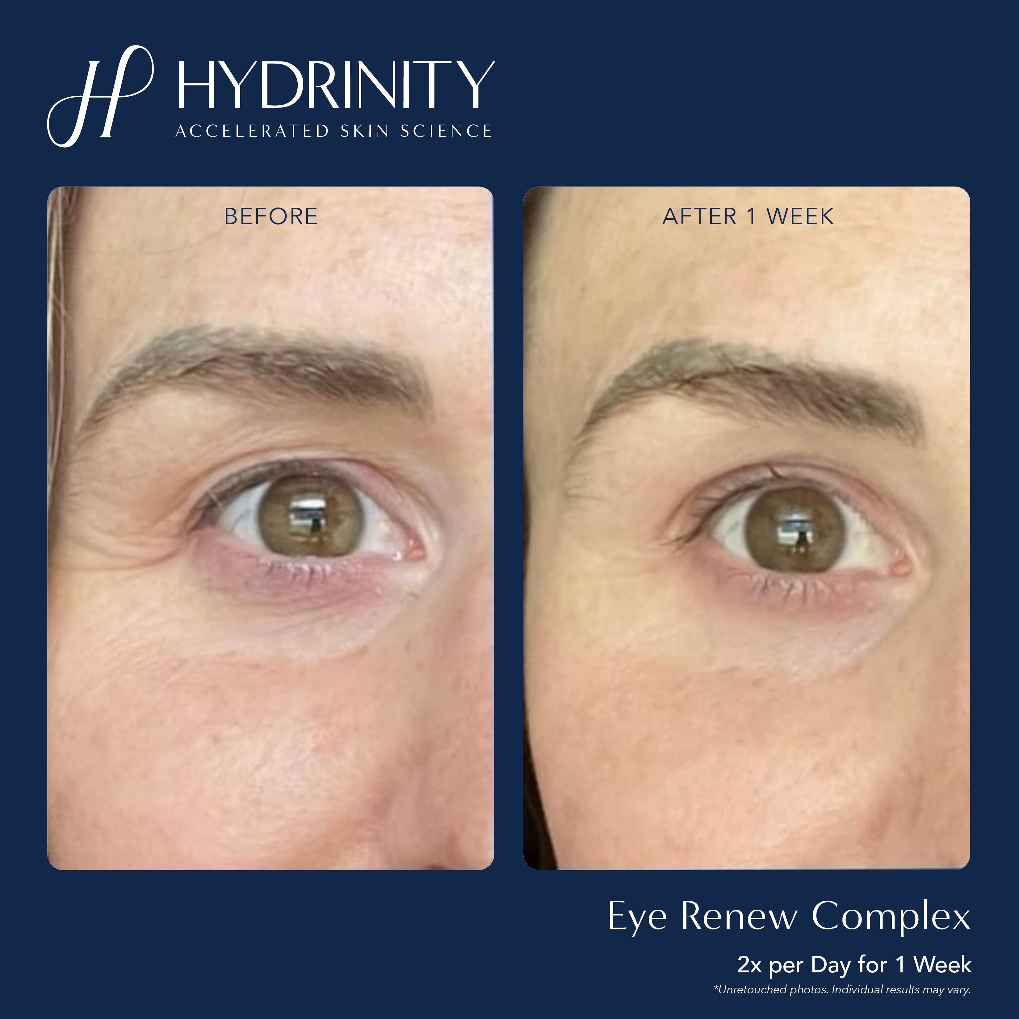 Eye Renew Complex - MariposaSkincare.com