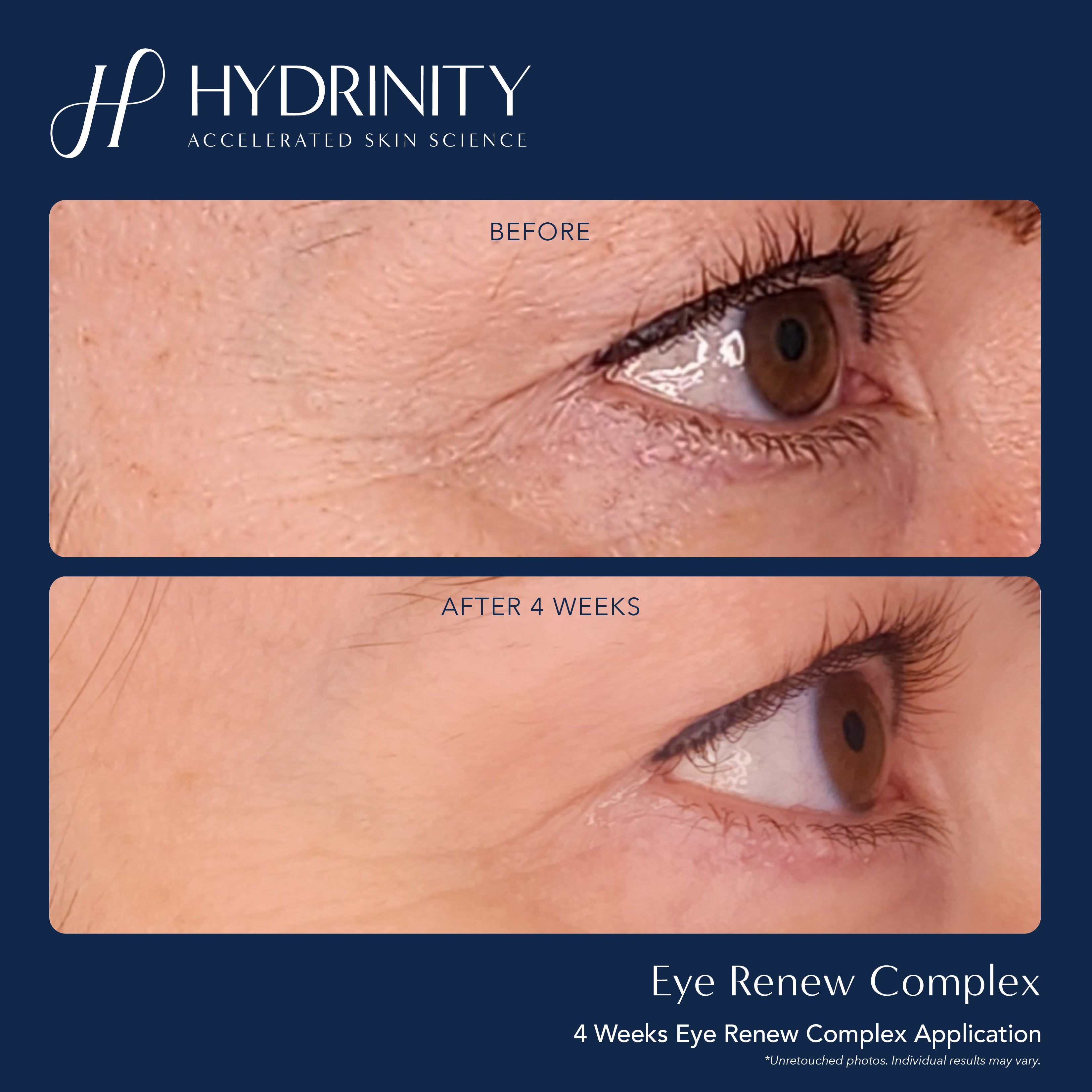 Eye Renew Complex - MariposaSkincare.com