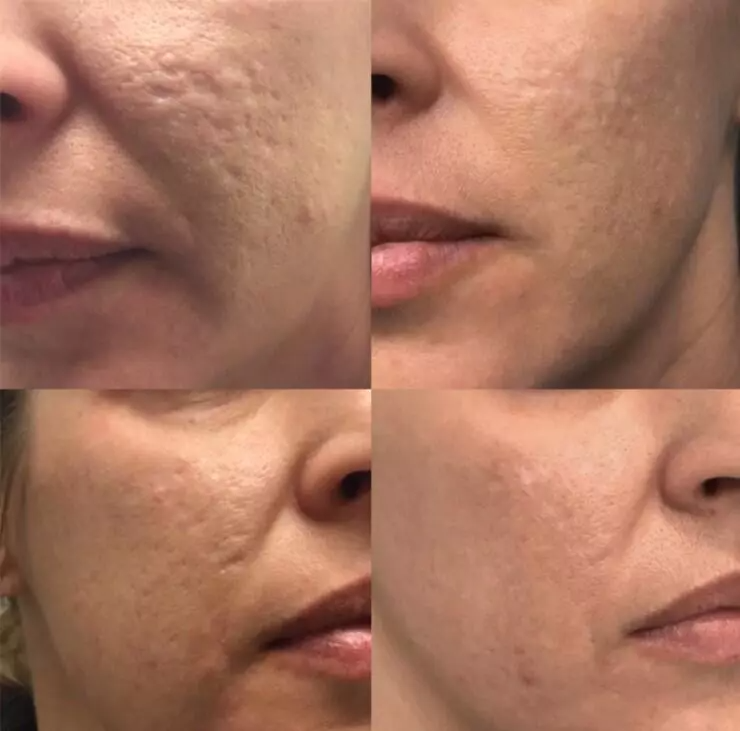 Skin Revitalizing Complex Treatment Kit