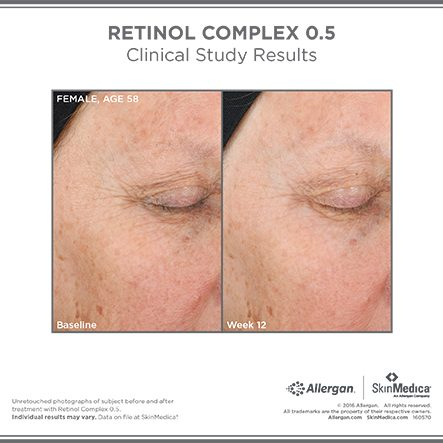 Retinol Complex 0.5 - MariposaSkincare.com