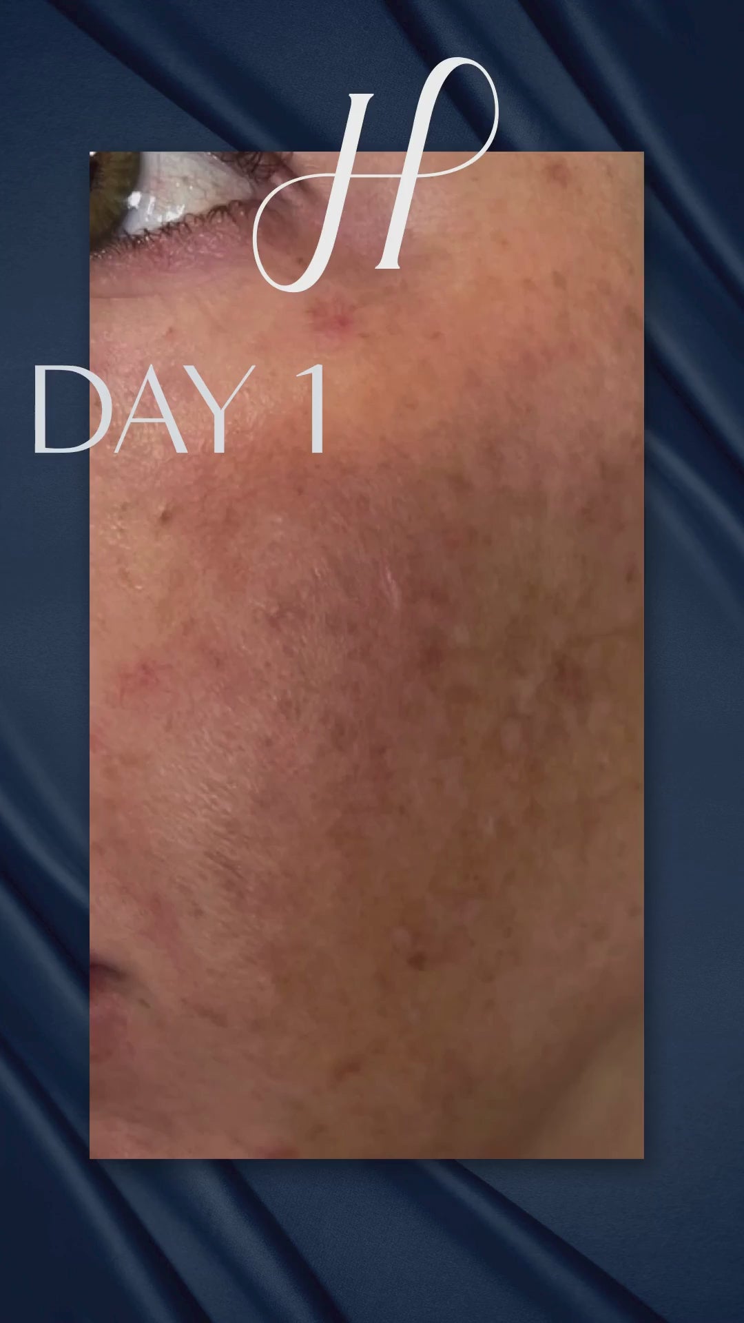 Load video: VIVID Brightening Serum